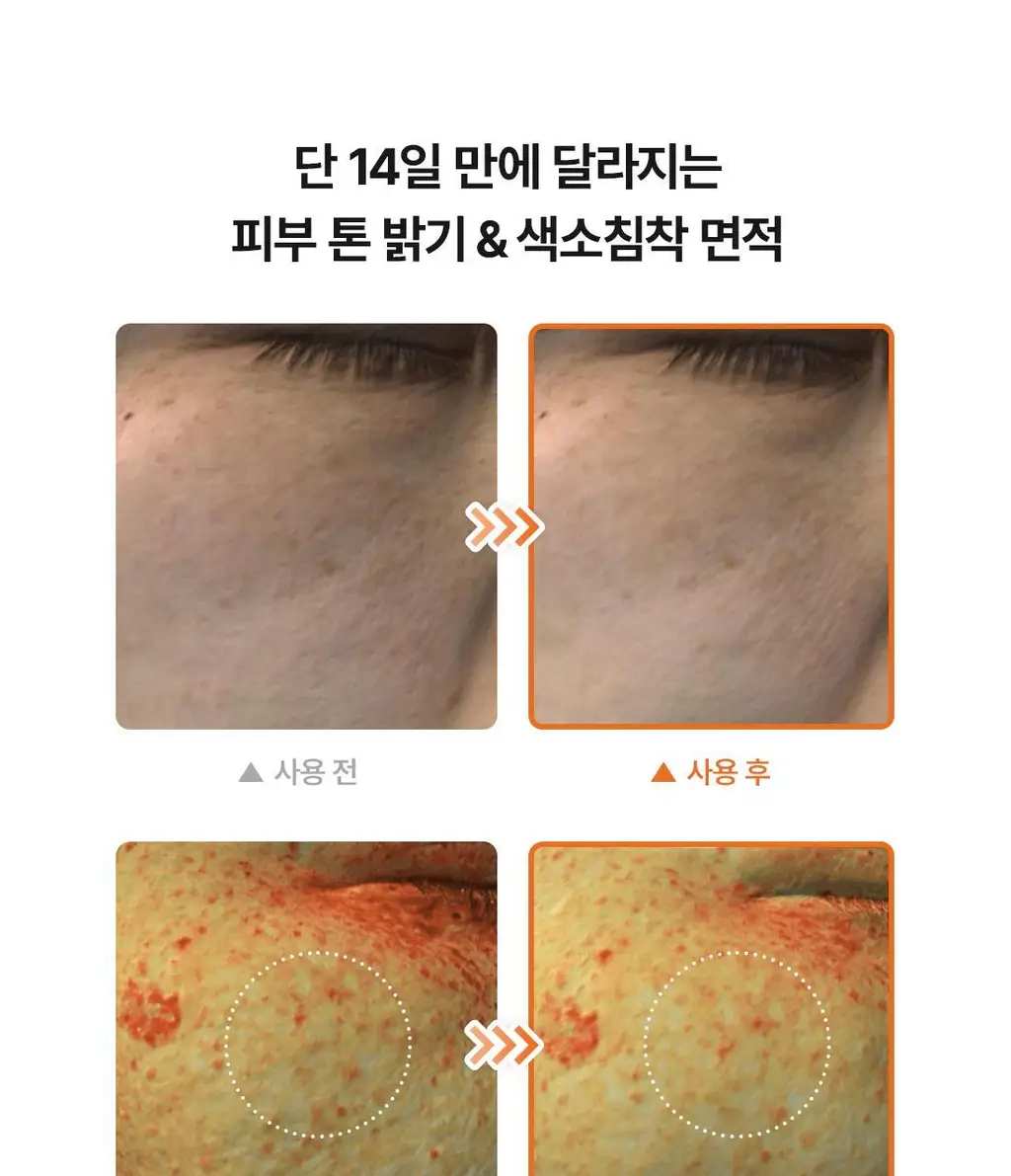 [잡티미백] 닥터엘시아 비타민C 부스팅 세럼 30ml 상세페이지 7